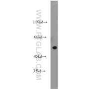 TRAIP Rabbit Polyclonal Antibody (10332-1-AP)