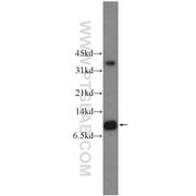 LSM8 Rabbit Polyclonal Antibody (10134-1-AP)