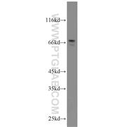 MYCN Rabbit Polyclonal Antibody (10159-2-AP)