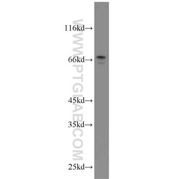 MYCN Rabbit Polyclonal Antibody (10159-2-AP)