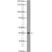 TMOD1 Rabbit Polyclonal Antibody (10145-1-AP)