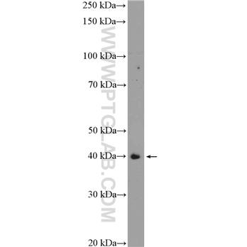 TMOD1 Rabbit Polyclonal Antibody (10145-1-AP)
