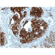 KRT13 Rabbit Polyclonal Antibody (10164-2-AP)