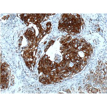 KRT13 Rabbit Polyclonal Antibody (10164-2-AP)