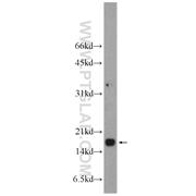 DAD1 Rabbit Polyclonal Antibody (10531-1-AP)
