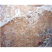 KEAP1 Rabbit Polyclonal Antibody (10503-2-AP)