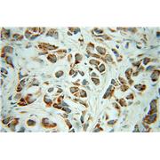 CHRNA3 Rabbit Polyclonal Antibody (10333-1-AP)