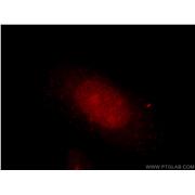 DUSP11 Rabbit Polyclonal Antibody (10204-2-AP)