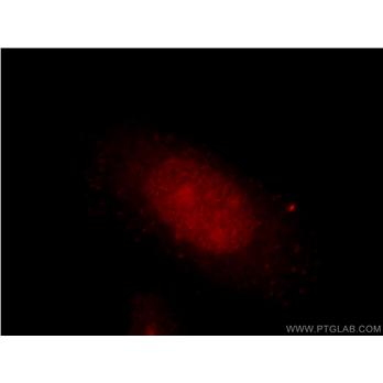 DUSP11 Rabbit Polyclonal Antibody (10204-2-AP)