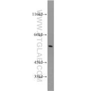 TCP1 Rabbit Polyclonal Antibody (10320-1-AP)