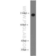 DBN1 Rabbit Polyclonal Antibody (10260-1-AP)