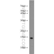 SNRPD3 Rabbit Polyclonal Antibody (10379-1-AP)