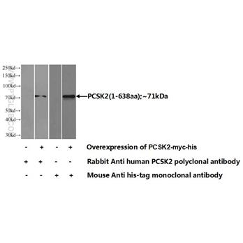 PCSK2 Rabbit Polyclonal Antibody (10553-1-AP)