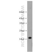 TCL1A Rabbit Polyclonal Antibody (10475-1-AP)