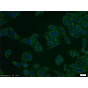 WHSC2 Rabbit Polyclonal Antibody (10456-1-AP)