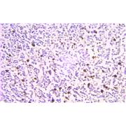 PTMA Rabbit Polyclonal Antibody (10480-1-AP)