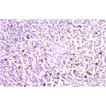 PTMA Rabbit Polyclonal Antibody (10480-1-AP)