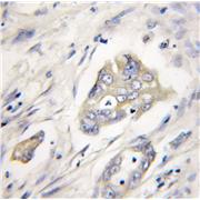 XIAP Rabbit Polyclonal Antibody (10037-1-Ig)