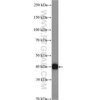 PRKAB1 Rabbit Polyclonal Antibody (10308-1-AP)