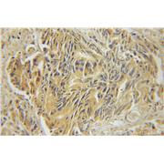 Marcks Rabbit Polyclonal Antibody (10004-2-Ig)