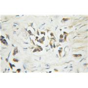 CASP6 Rabbit Polyclonal Antibody (10198-1-AP)