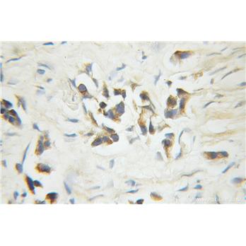 CASP6 Rabbit Polyclonal Antibody (10198-1-AP)