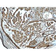 ANXA11 Rabbit Polyclonal Antibody (10479-2-AP)