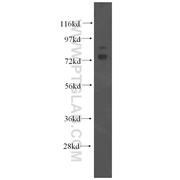OS9 Rabbit Polyclonal Antibody (10061-1-AP)