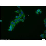 HGS Rabbit Polyclonal Antibody (10390-1-AP)