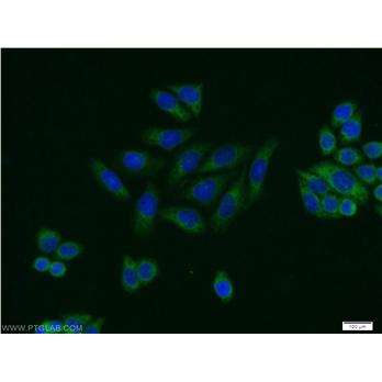 PRKAR2A Rabbit Polyclonal Antibody (10142-2-AP)
