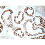 PPP2R4 Rabbit Polyclonal Antibody (10321-1-AP)