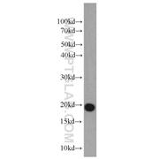 DR1 Rabbit Polyclonal Antibody (10406-1-AP)