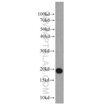 DR1 Rabbit Polyclonal Antibody (10406-1-AP)