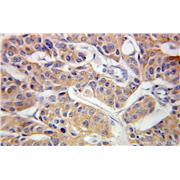 CLINT1 Rabbit Polyclonal Antibody (10470-1-AP)