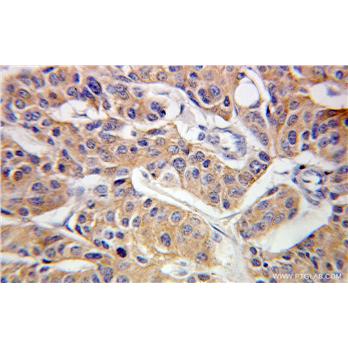 CLINT1 Rabbit Polyclonal Antibody (10470-1-AP)