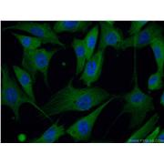 PACSIN2 Rabbit Polyclonal Antibody (10518-2-AP)