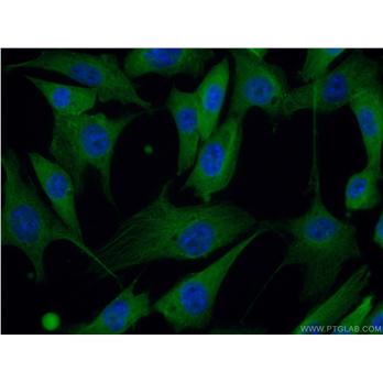 PACSIN2 Rabbit Polyclonal Antibody (10518-2-AP)