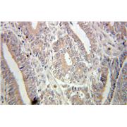 USP11 Rabbit Polyclonal Antibody (10244-1-AP)