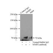 MMP2 Rabbit Polyclonal Antibody (10373-2-AP)
