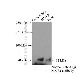MMP2 Rabbit Polyclonal Antibody (10373-2-AP)