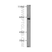 GTF2H1 Rabbit Polyclonal Antibody (10173-1-AP)