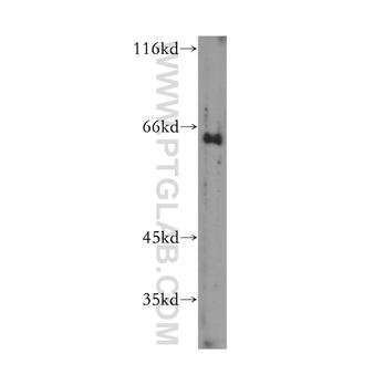 GTF2H1 Rabbit Polyclonal Antibody (10173-1-AP)