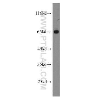 FANCG Rabbit Polyclonal Antibody (10215-1-AP)