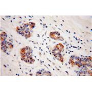 GJB1 Rabbit Polyclonal Antibody (10450-1-AP)