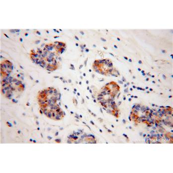 GJB1 Rabbit Polyclonal Antibody (10450-1-AP)