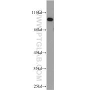 UBE3A Rabbit Polyclonal Antibody (10344-1-AP)