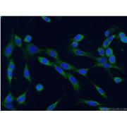 CALR Rabbit Polyclonal Antibody (10292-1-AP)