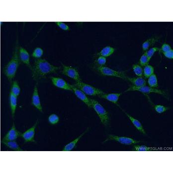 CALR Rabbit Polyclonal Antibody (10292-1-AP)