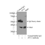 JTV1 Rabbit Polyclonal Antibody (10424-1-AP)