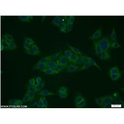 STARD5 Rabbit Polyclonal Antibody (10487-1-AP)